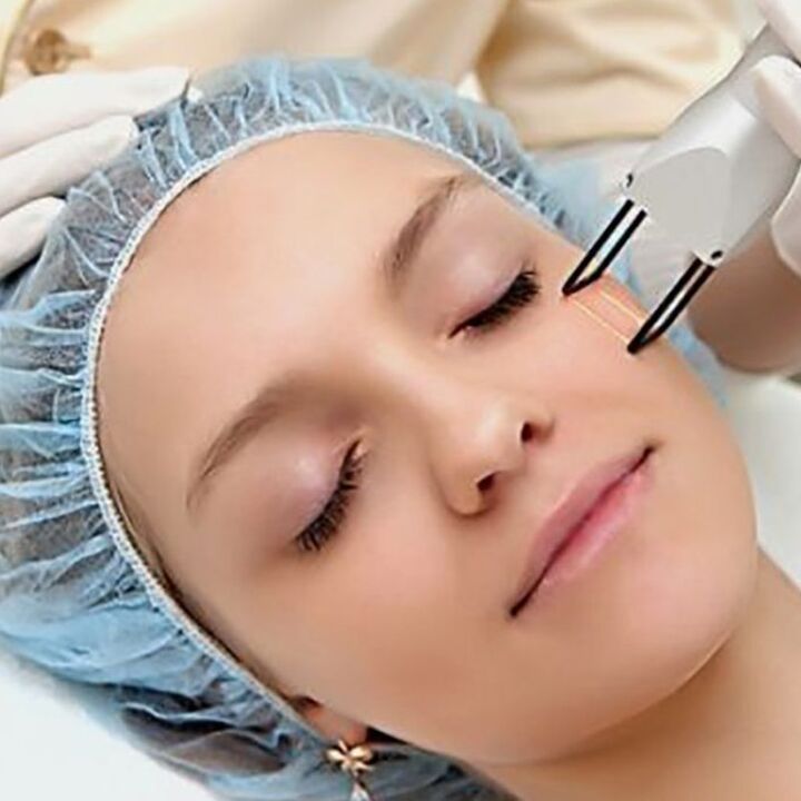 Ang Refuctional Rejevenation sa Laser